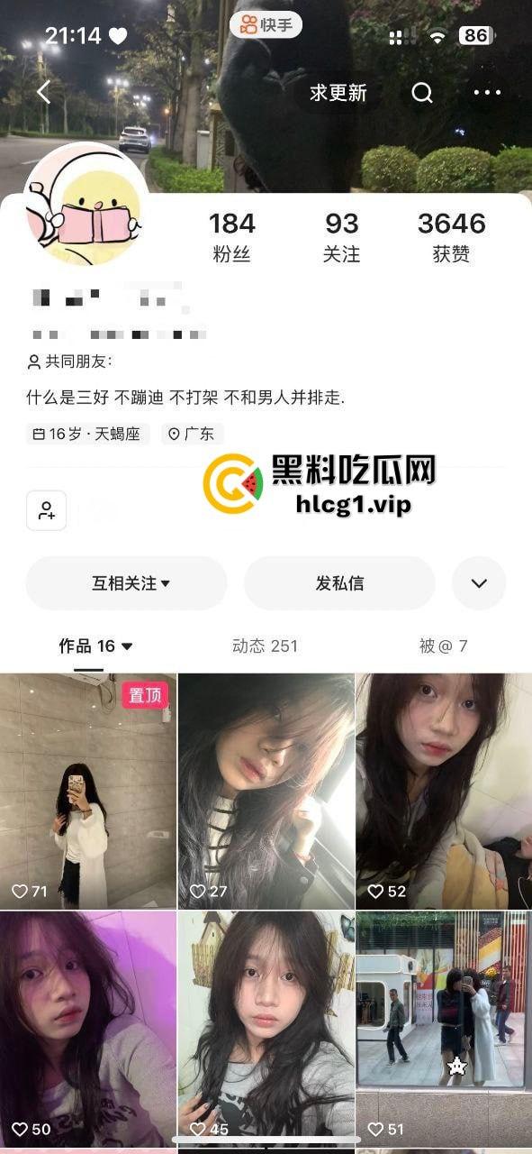 瓜友真实投稿血的教训，以为约炮买一送一！一包烟换来双份激情，却惨遭生化母体感染HPV！-1