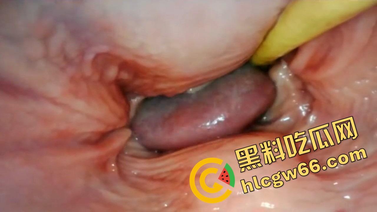 欧美巨屌狂插内窥视角爆火阴道深处褶皱翻卷、肉壁收缩蠕动，全程高清记录快感源头！-10