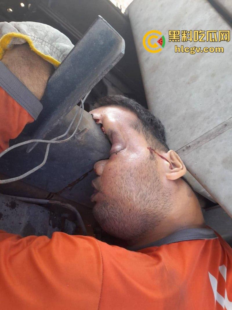 太惨了！因操作不当 巴西倒霉男子脑袋被挤爆  血腥现场视频曝光 胆小慎入-5