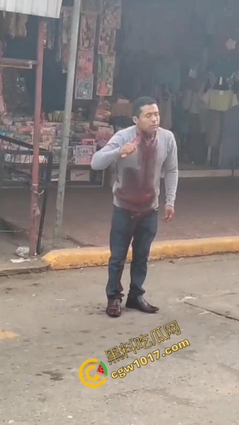 国外男子竟当街自残，刀割喉咙鲜血四溅，群众惊恐围观，男子倒地不省人事，惨烈一幕令人心悸胆战！-8