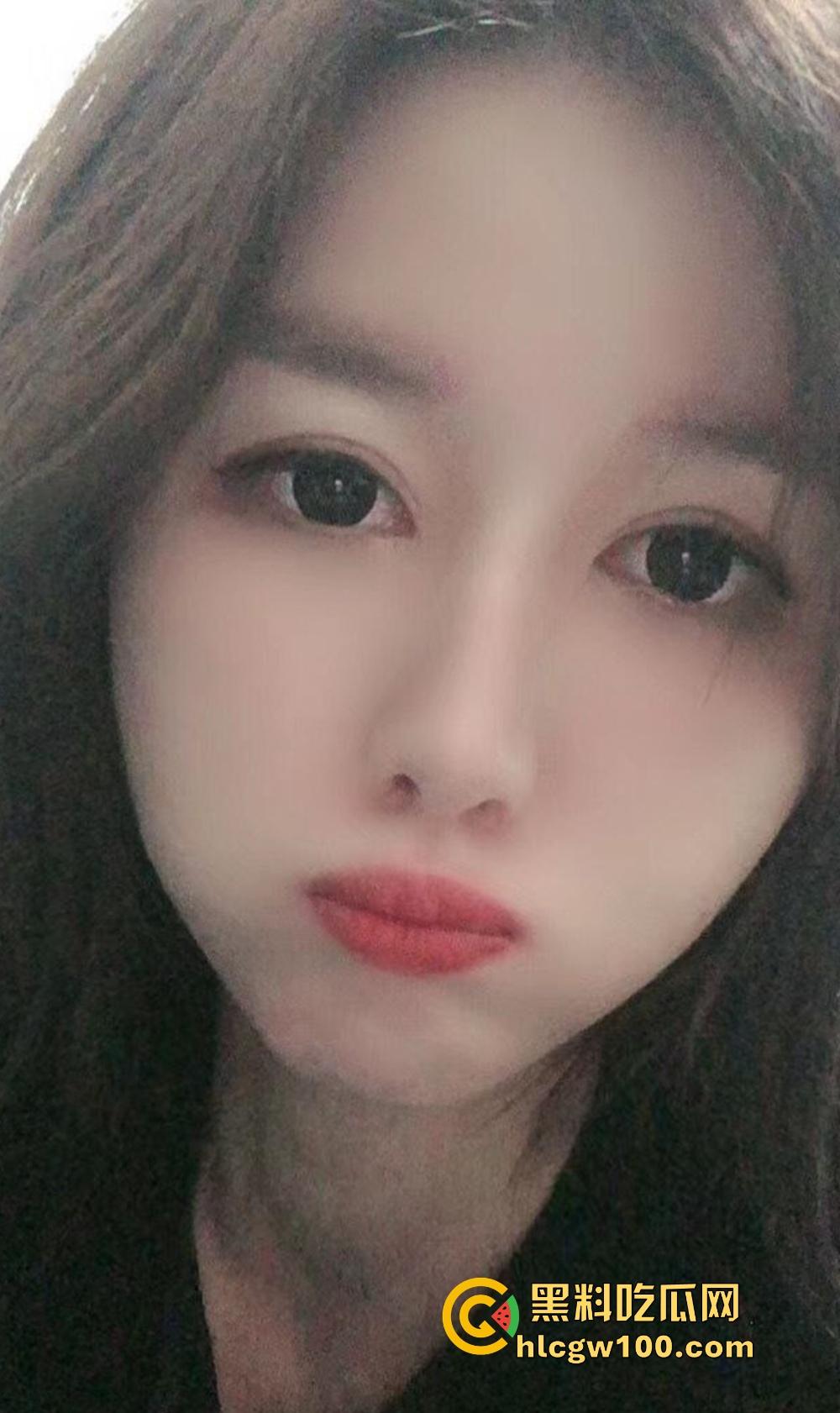 合肥小表姑成骚浪尤物,比我大几岁的小少妇,从矜持到主动求操,骚穴水多粘嘴,内射多次都快怀孕了!-3