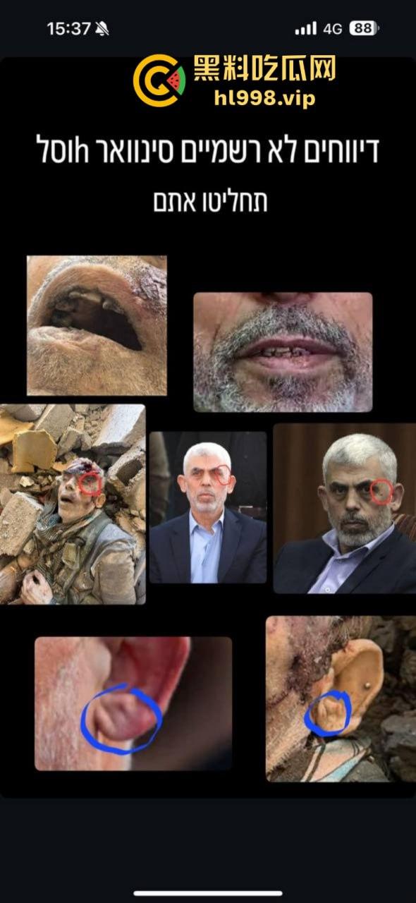 慎入！！！哈马斯领导人辛瓦尔被以方爆头击毙 遗体照片流露不忍直视！-9