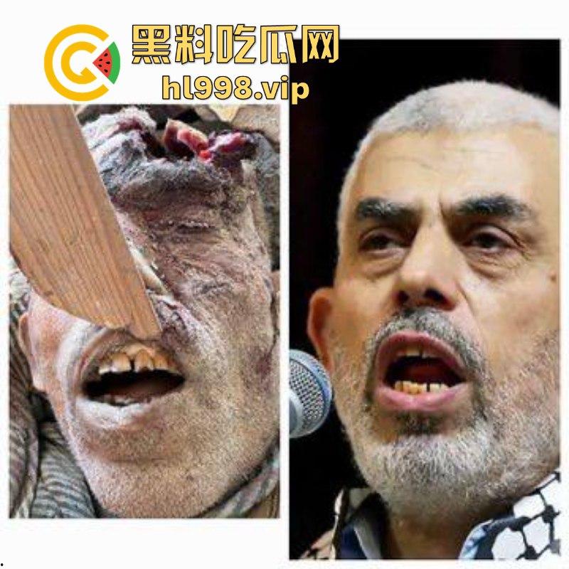 慎入！！！哈马斯领导人辛瓦尔被以方爆头击毙 遗体照片流露不忍直视！-11