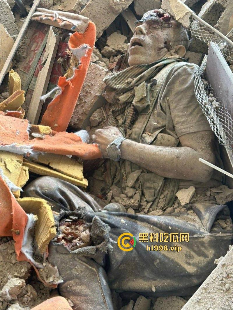 慎入！！！哈马斯领导人辛瓦尔被以方爆头击毙 遗体照片流露不忍直视！-12