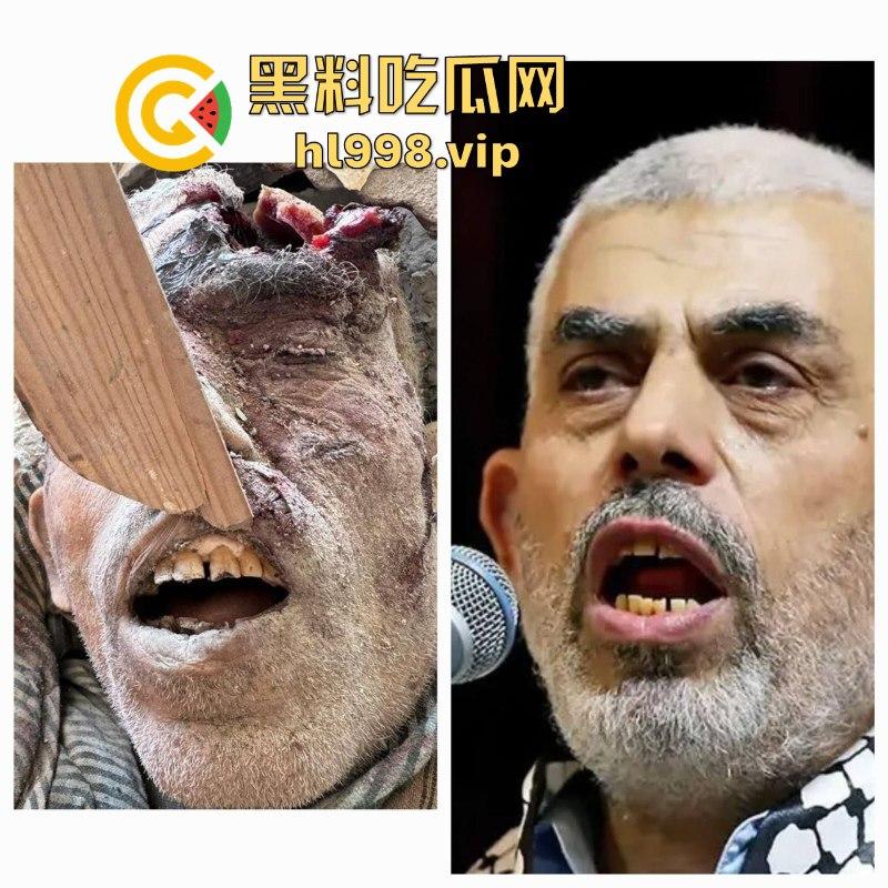 慎入！！！哈马斯领导人辛瓦尔被以方爆头击毙 遗体照片流露不忍直视！-16