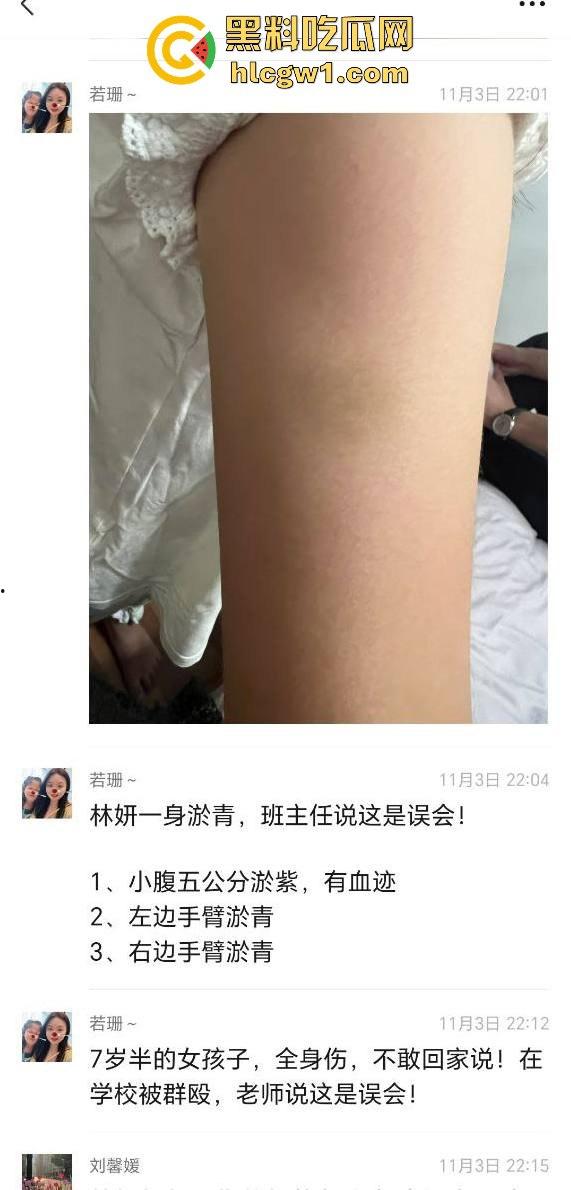 广州金隆小学曝惊天丑闻!初中学生遭体罚虐待,遍体鳞伤,家长被辱骂怒火中烧!-2