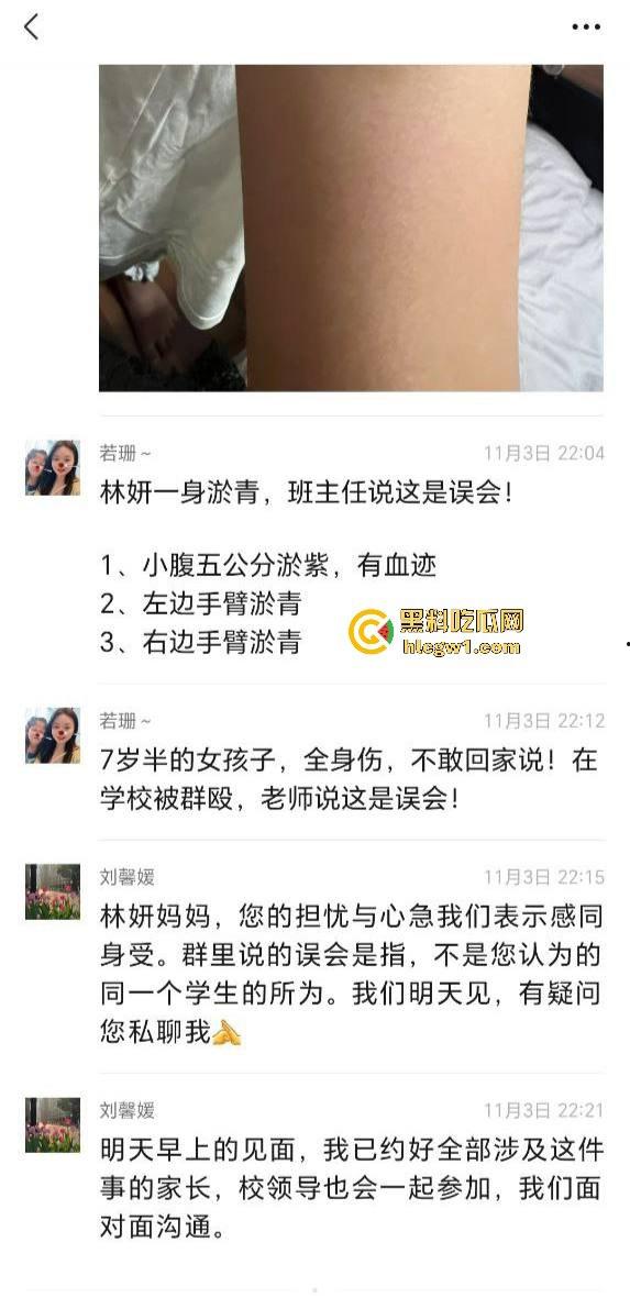 广州金隆小学曝惊天丑闻!初中学生遭体罚虐待,遍体鳞伤,家长被辱骂怒火中烧!-3