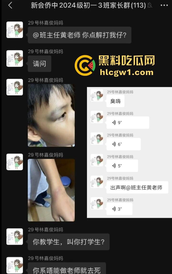 广州金隆小学曝惊天丑闻!初中学生遭体罚虐待,遍体鳞伤,家长被辱骂怒火中烧!-8