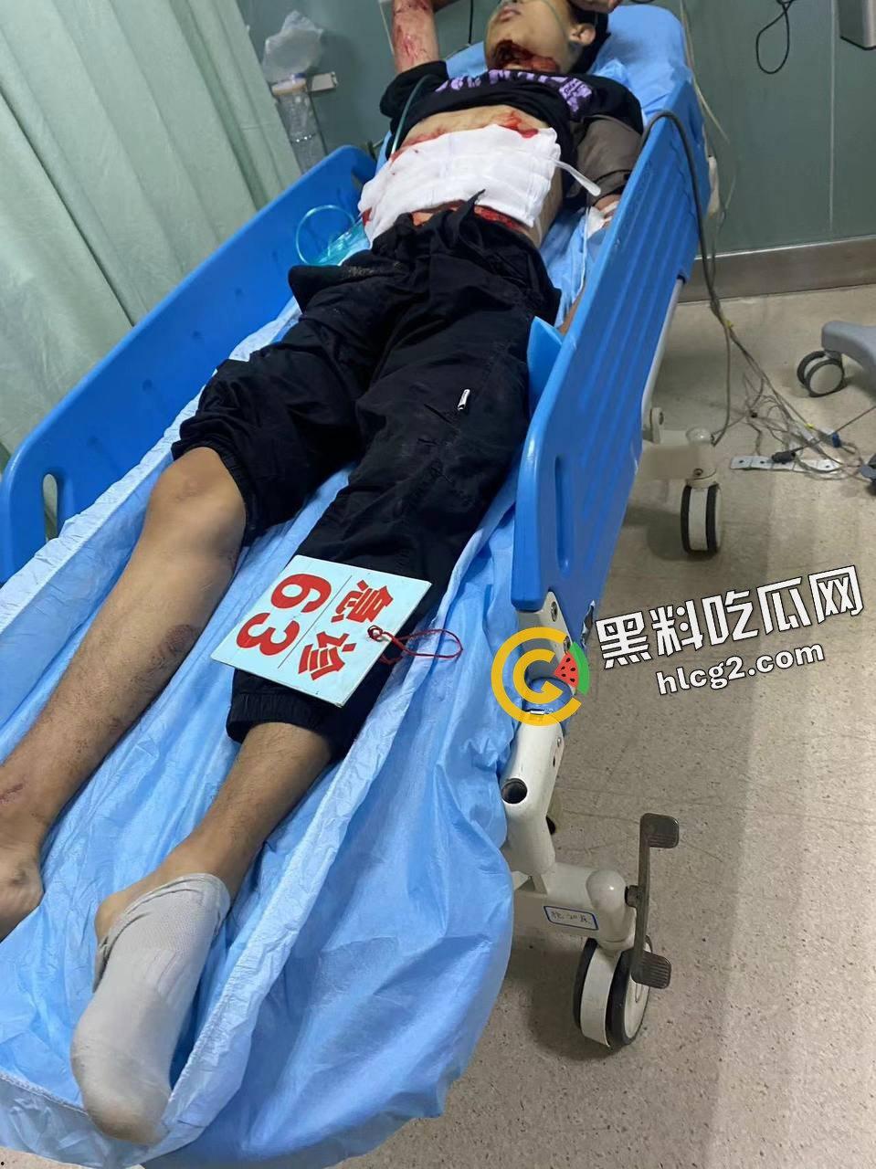 慎人事件！江苏苏州影豹R车主逆行 撞飞摩托车 连人带车坠落引擎盖 重重砸伤晕厥-16