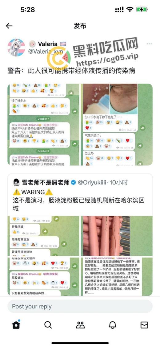 毁三观！逆天男娘在哈尔滨投毒被举报 性病晚期浑身流脓还准备卖塞进过自己直肠的烤肠创业 被热心群友举报进局子-4