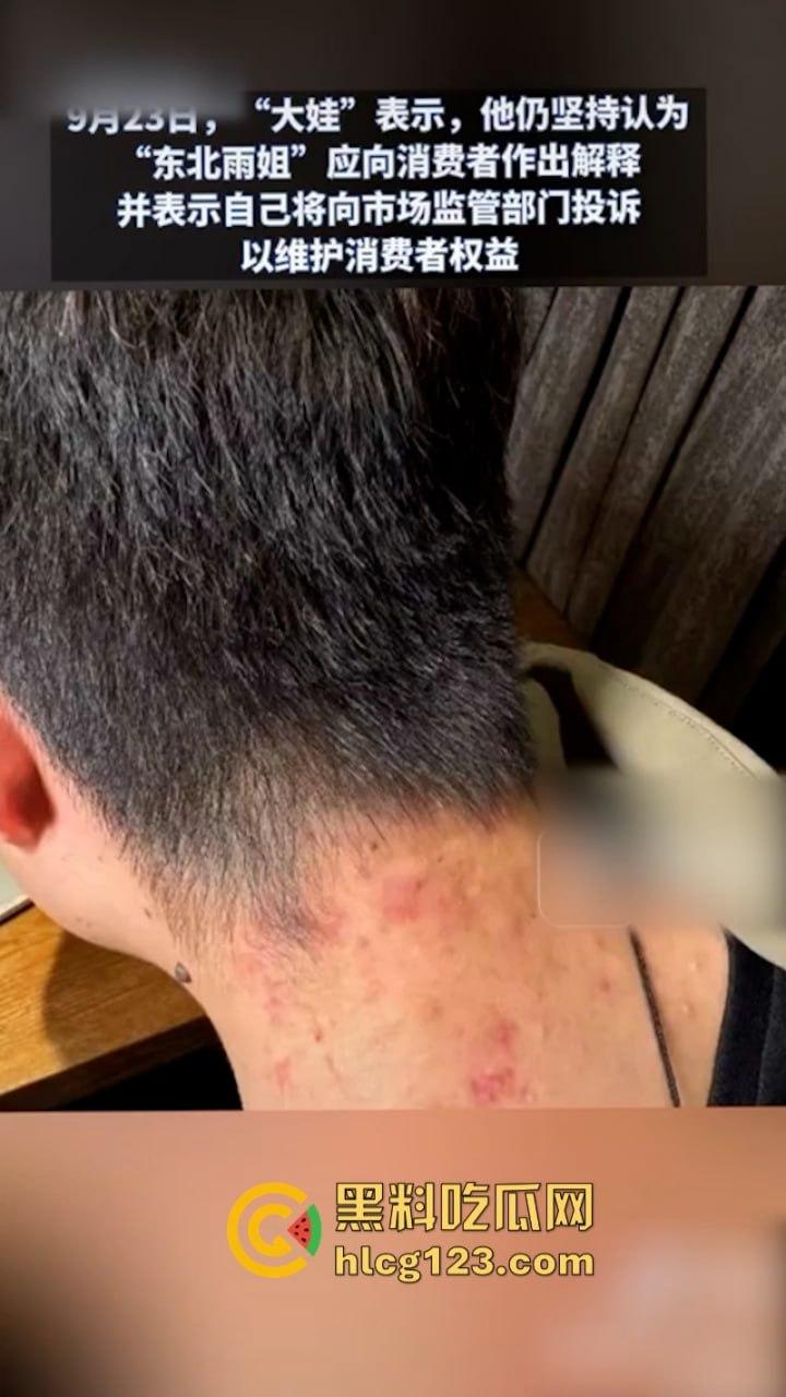 一分钟收入100w？抖音千万网红 【东北雨姐】售卖假红薯粉粉涉嫌虚假宣被打假！-2