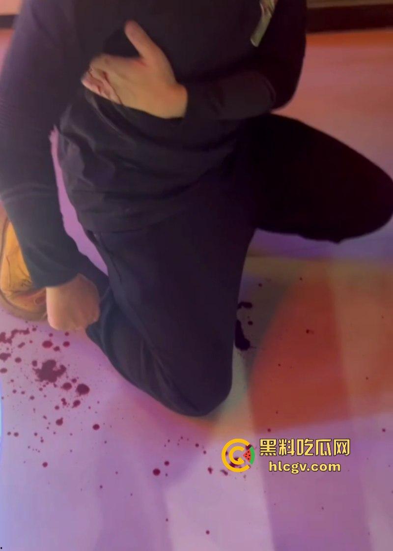 江苏南通小米su7小伙大战摩托人后续 小伙单杀一人 嘲讽哥侥幸存活 朋友惨被祭天!-6