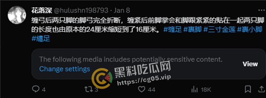 新时代裹脚女性！00后女生爱上裹脚 推特分享裹脚经历 把脚缠到骨折变形 吓人！-2