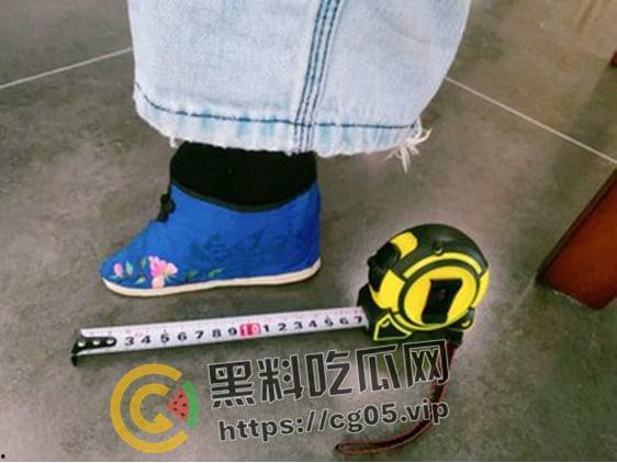 新时代裹脚女性！00后女生爱上裹脚 推特分享裹脚经历 把脚缠到骨折变形 吓人！-4