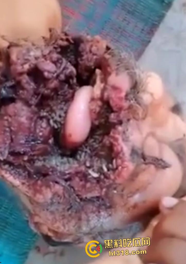 埃及老人惨遭机器重击，脸烂成浆五官全毁，只能阿巴阿巴发声音，不能说话，估计过几天就要长蛆了！-3