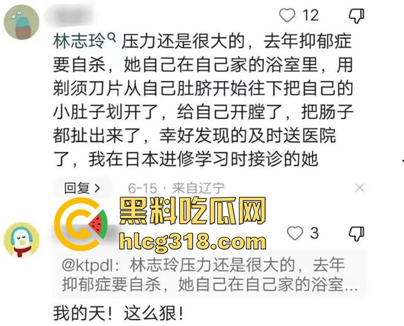 林志玲嫁入日本后真实近况，不仅被老公殴打家暴，还用她的身体交换资源，甚至多次玩换妻游戏！-1