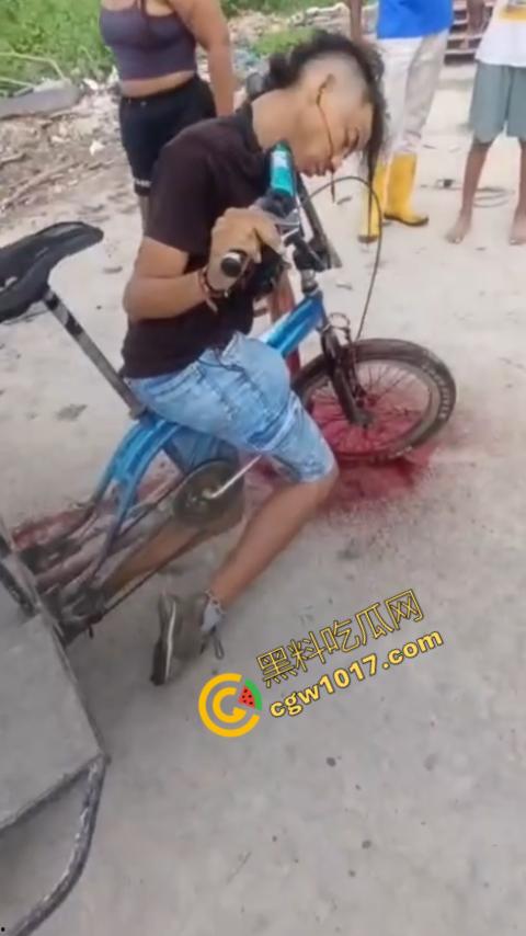 恐怖视频曝光！小伙头颅神秘贯穿，三轮车穿颅血染街头血腥现场骇人惊魂，神秘死亡惊掉下巴！-1