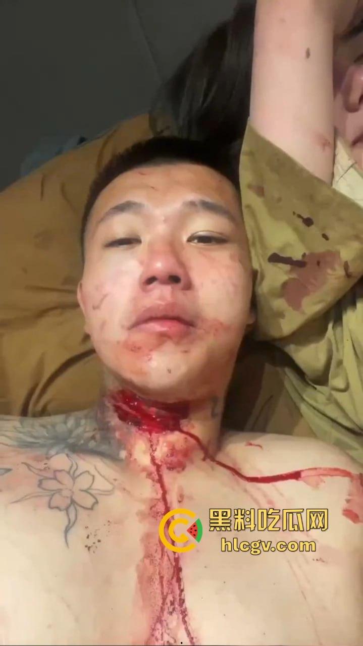 朋友圈成了血腥展示场？王湳权手刃女友后发朋友圈，画面直击心灵，血腥内容慎入！-13