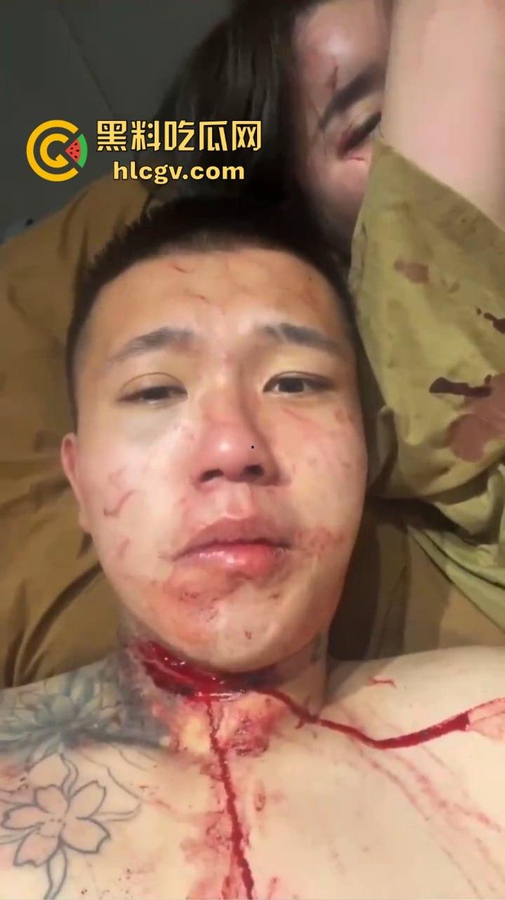 朋友圈成了血腥展示场？王湳权手刃女友后发朋友圈，画面直击心灵，血腥内容慎入！-14