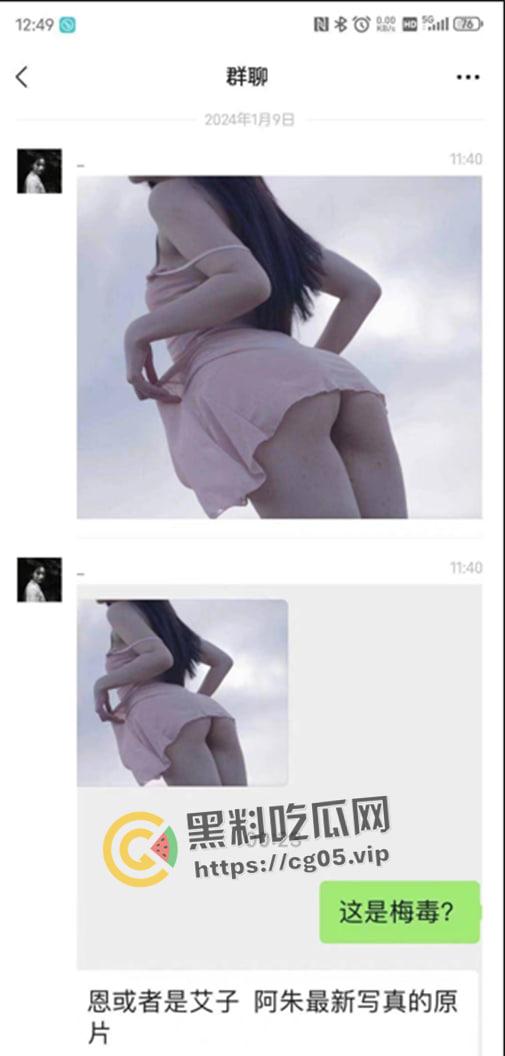 鸡圈顶流【阿朱】疑似患有梅毒?被细心网友拿着放大镜看深究美图,难道是上个月参加淫趴所得?-1