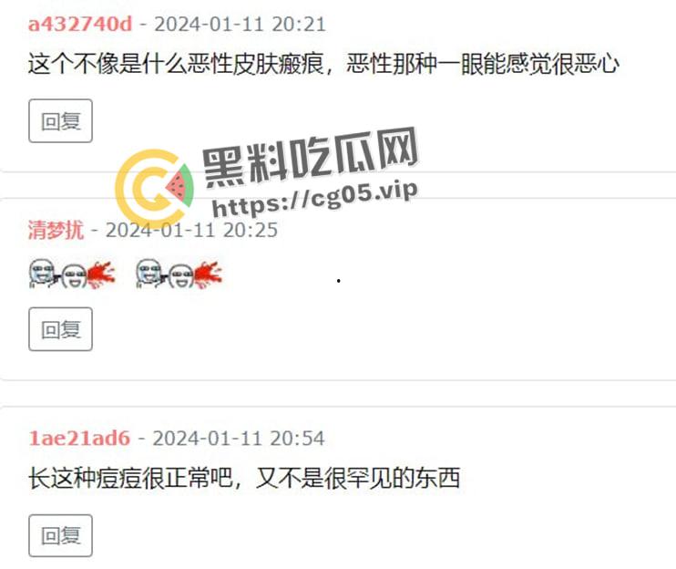 鸡圈顶流【阿朱】疑似患有梅毒?被细心网友拿着放大镜看深究美图,难道是上个月参加淫趴所得?-10