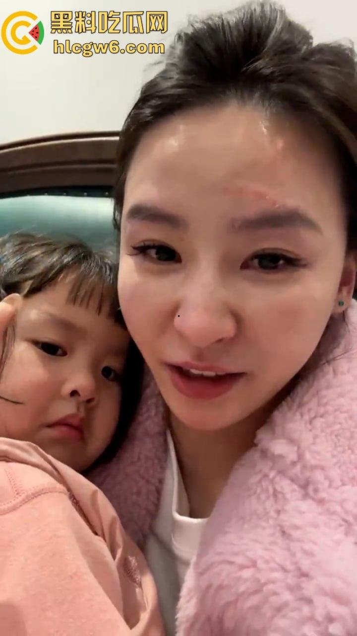 湖北一小学美女老师抖音自曝离婚探女遭前夫爹殴打抓脸全身多处受伤 伤情实拍曝光！都是血口子-3