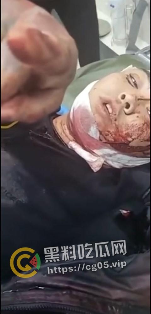 精神小伙哈尔滨斯卡拉迪厅前挑衅!上一秒嚣张至极 下一秒被打成猪头 活该-4