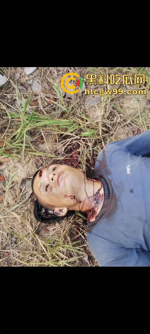 哥伦比亚武装冲突，现场死伤无数遍地尸体， 上万人流离失所!总统宣布: 进入紧急状态!-4