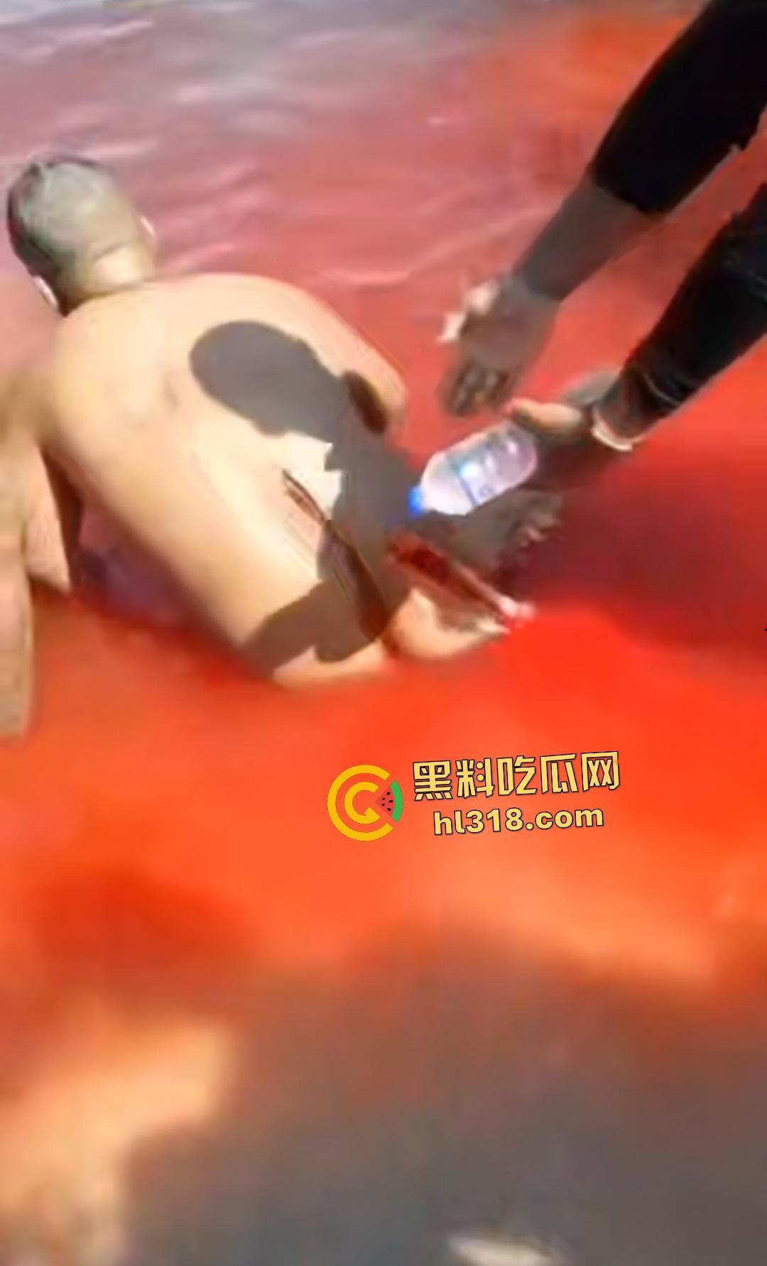 黑人男子海边遭螺旋桨血腥绞杀！下半身肉烂血染红海，旁人妄图复原断肢，谁知身体差点变两半！-3