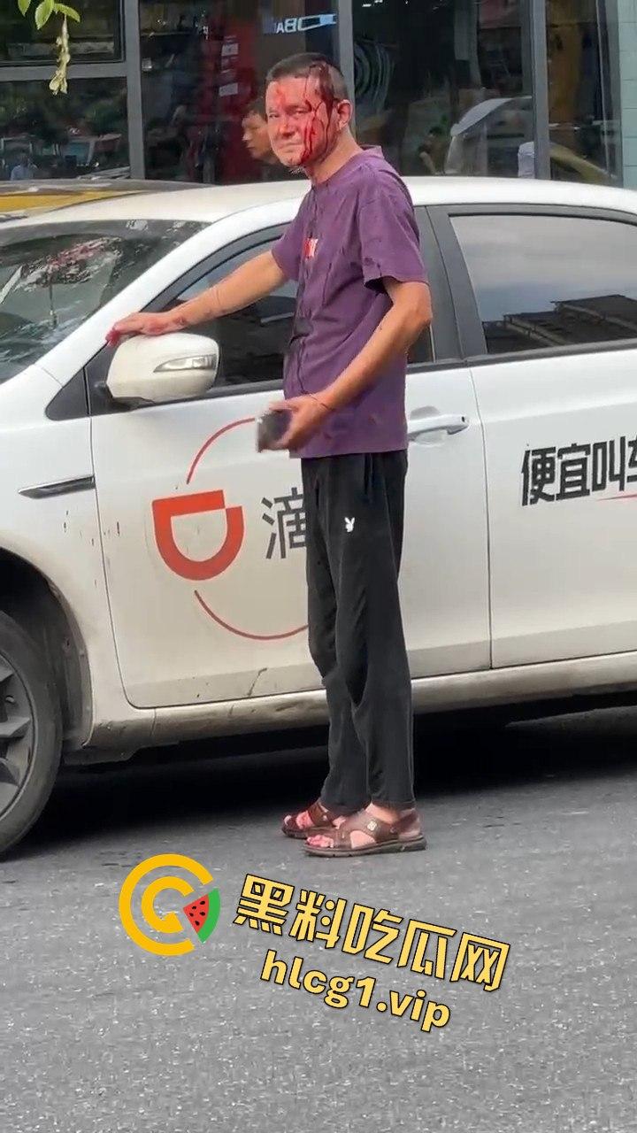 女子因价格争执叫来老公，掏出扳手开瓢，赔偿金额够买辆新车！-6