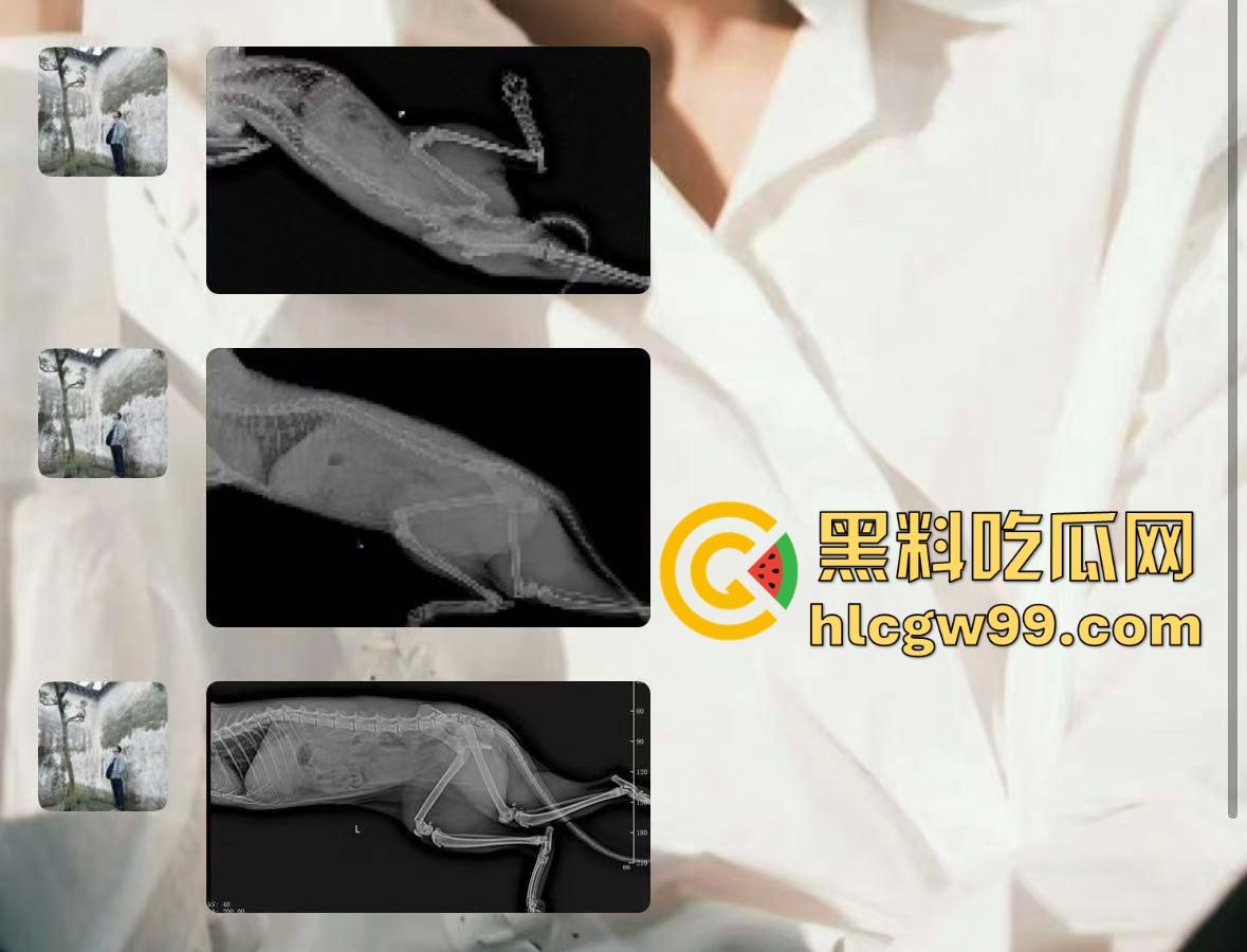 主播故事汇！渣男网红【凯蒂斯】余李，携带病毒到处约炮，致【冉潇潇】怀孕搞原地消失，PPT手撕渣男。-38