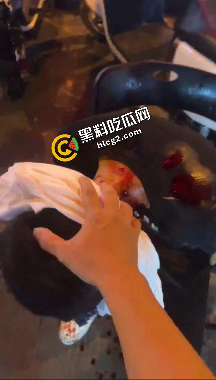 广西玉林南兴广场 精神病男子袭击广场砍人 下死手砍颈动脉 血迹斑斑!致4名小孩受伤!-8