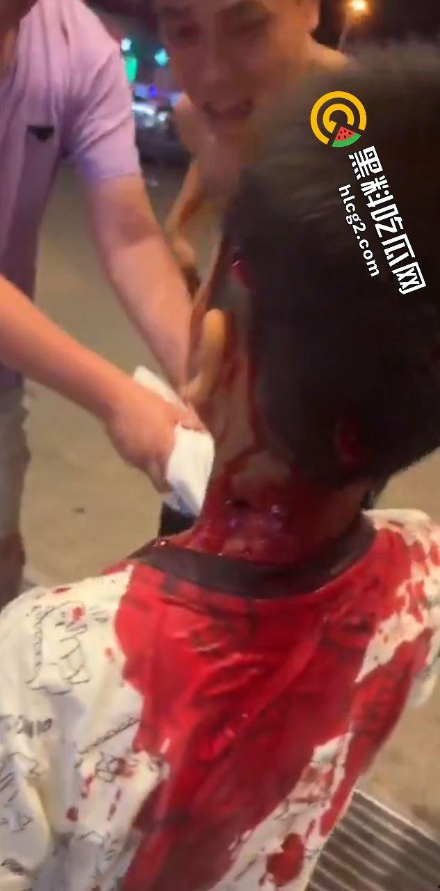 广西玉林南兴广场 精神病男子袭击广场砍人 下死手砍颈动脉 血迹斑斑!致4名小孩受伤!-9