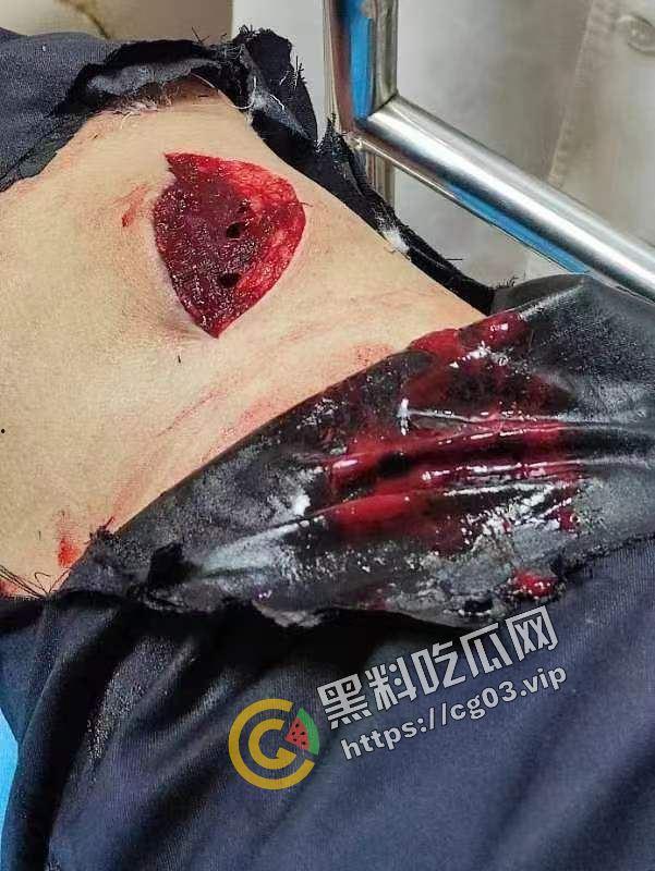 嚣张！广西容县城北路少年砍人 与警察互博 砍伤警察 拒不伏法 嚣张至极-4