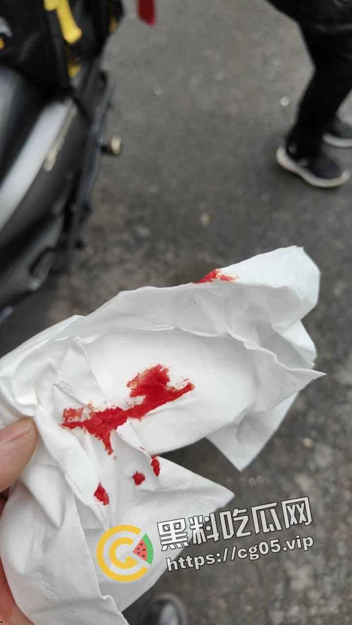 新年遇贵人！重庆渝中摩托佬莫名其妙被奥迪别车三次还挨打 事后律师表示不会少于五万 挨打挨出来一辆新摩托-6