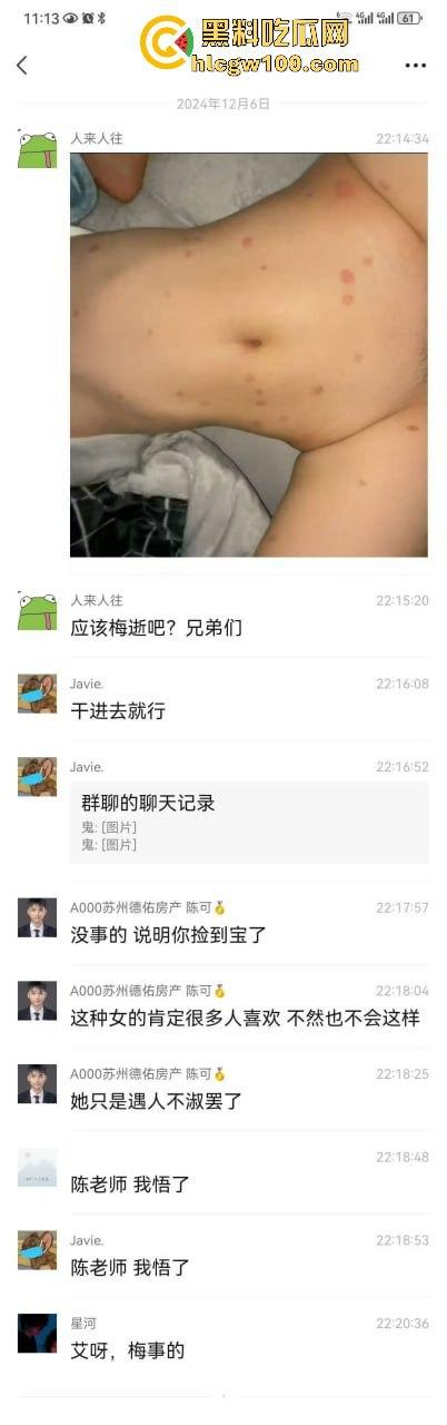 河南信阳啤酒森林酒吧惊现病毒母体！毒王身体浑身溃烂吓退众人，最近国内真的特别多各位瓜友一定要注意。-10