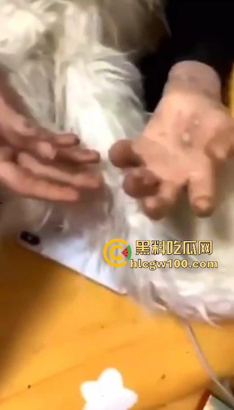河南信阳啤酒森林酒吧惊现病毒母体！毒王身体浑身溃烂吓退众人，最近国内真的特别多各位瓜友一定要注意。-16