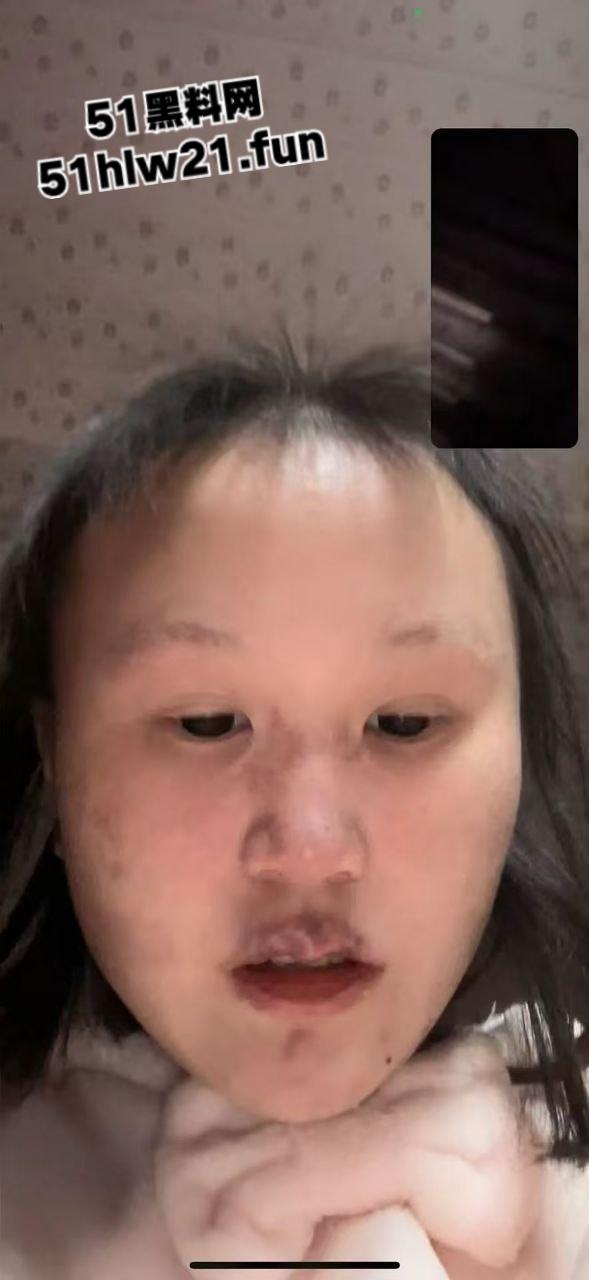 重庆生化母体【刘思婷】美化身份装女神到处卖骚，体生烂疮还继续约炮散毒。-9