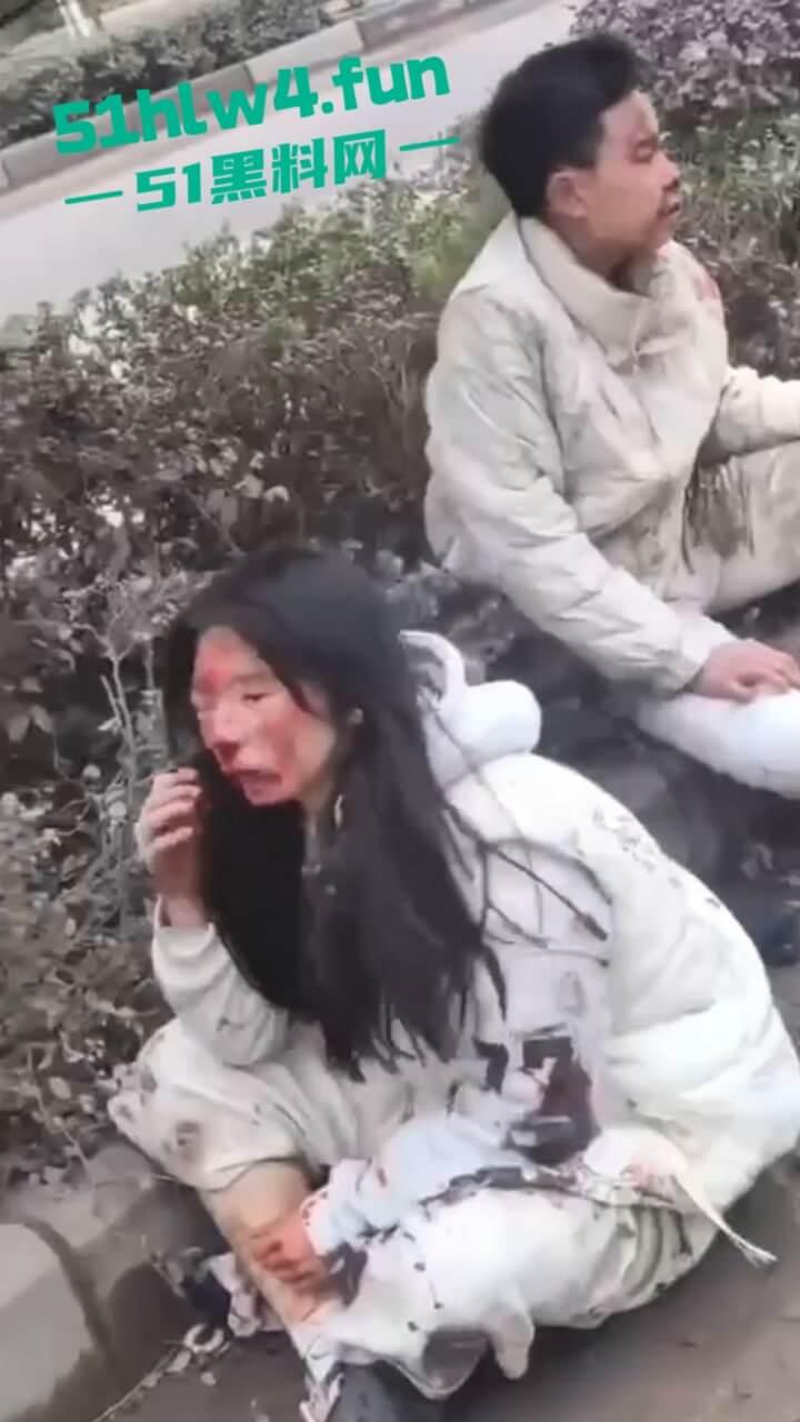 内江资中奇葩车祸五菱宏光加速超车，竟然失控出车祸俩人都变成熊猫脸，看着太搞笑了。-8