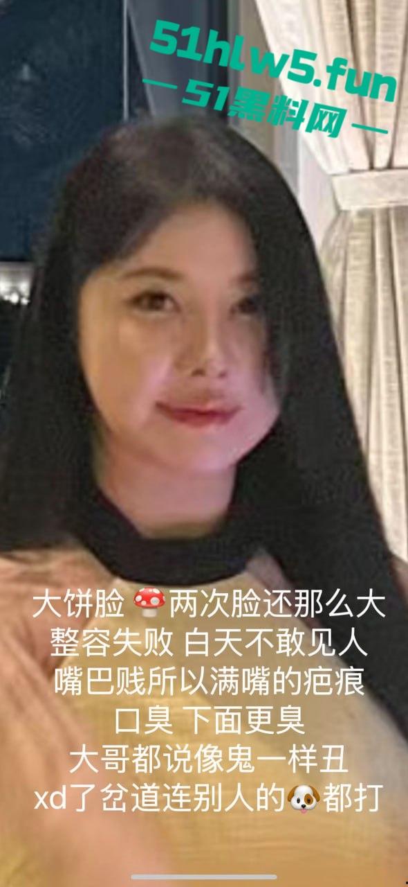 西安野鸡丑女【吕晶晶】P假照骗钱骗炮，吸毒卖逼超级恶臭喜提戒毒所！-7