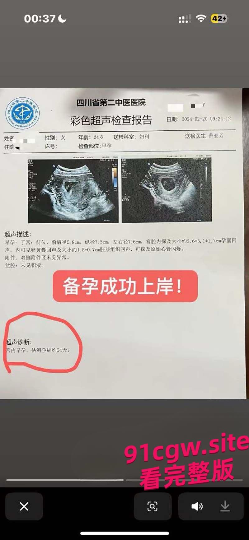 机车圈小仙女520约炮 两天后甩B超单装怀孕找接盘侠！-10