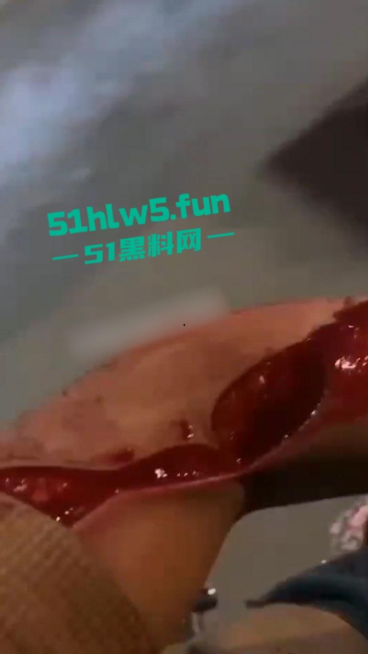重口血腥场面慎点！广东普宁cw电竞社精神小伙线下真实暴砍对手致皮开肉绽。-3