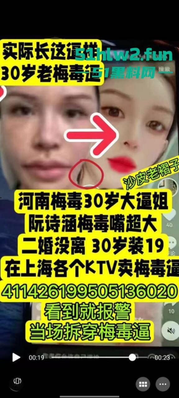 夜场梅毒女【阮诗涵】装嫩卖逼传毒坑害多人，仍在抖音撒网捕鱼专骗老实人全网避雷！-3