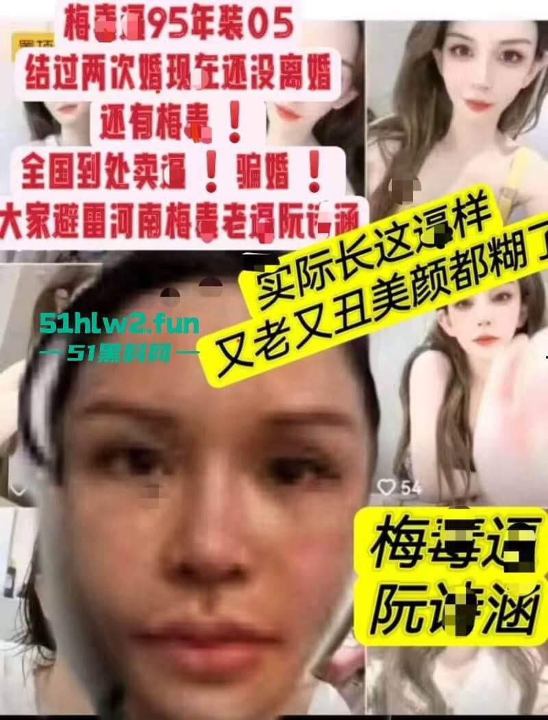 夜场梅毒女【阮诗涵】装嫩卖逼传毒坑害多人，仍在抖音撒网捕鱼专骗老实人全网避雷！-5