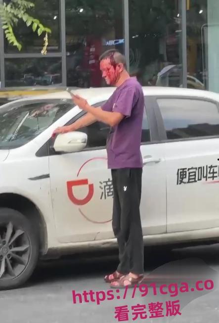 南京女子坐网约车要求司机送进小区！司机拒绝后被女子丈夫持扳手砸伤脑袋！-7