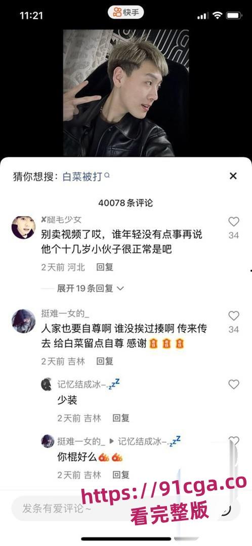 快手网红精神小伙「白菜」遭遇暴打黑历史曝光！酒店内群殴引发热议！-2