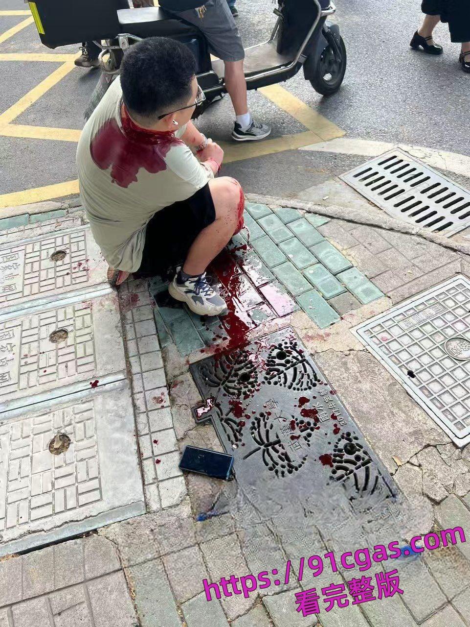 网传湖北武汉大学食堂发生随机斩人案，有多人受伤。-6