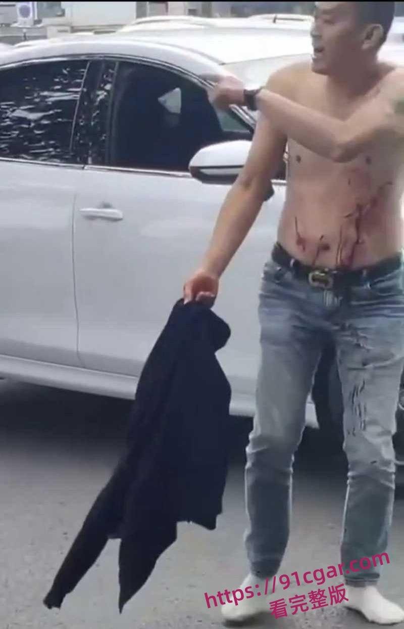 路怒症街头打架白鞋男子拿小刀捅黑鞋男血液瞬间流出 马路矛盾升级司机激烈冲突惊险又刺激-7