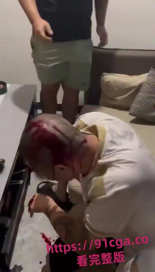 中国绑匪在菲律宾内讧 上演血腥狗咬狗 头破血流枪口相向-1